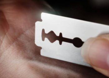 The stepmother cut off the minor’s face with a blade